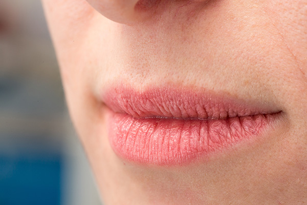 Trockene, raue Lippen